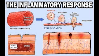 THE INFLAMMATORY RESPONSE [upl. by Laure]