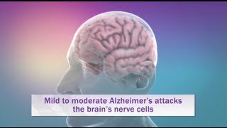 Alzheimers Disease Explained in 6 minutes with Animation [upl. by Scotney459]