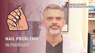 Nail Problems in Psoriasis [upl. by Adnertal819]