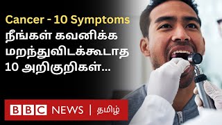 Cancer 10 Symptoms இதை சீக்கிரம் கவனிச்சிட்டா Treatment மூலம் குணப்படுத்திவிடலாம் [upl. by Nannah]