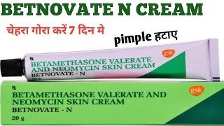 Betnovate N Cream  Betamethasone Valerate And Neomycin Skin Cream Review [upl. by Bega]