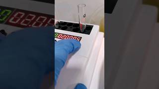 Triglycerides test of a lipemic serum sample medtech laboratory medtechstudent rmt medtechknows [upl. by Estas]