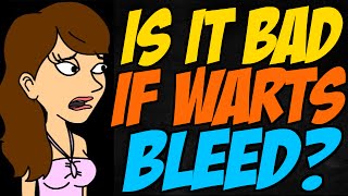 Is it Bad if Warts Bleed [upl. by Barrus]