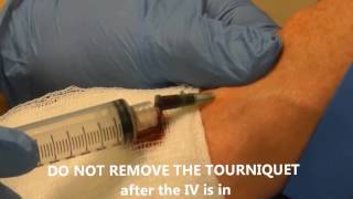 IV Insertion with Lab Draw [upl. by Alphonsine]