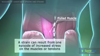 Lower Back Sprain and Strain Reasons [upl. by Tabshey568]