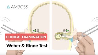 Weber and Rinne Test  Clinical Examination [upl. by Zilevi178]