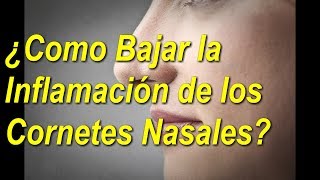 5 👀TRATAMIENTOS NATURALES para los 👃CORNETES de la NARIZ  Al 👉FINAL QUEDARAS 😲SORPRENDIDO [upl. by Ciccia]