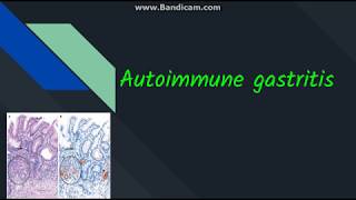 Autoimmune gastritis [upl. by Keever]