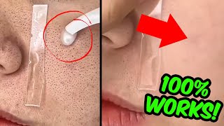 How To REMOVE Large Open Pores From Face amp Nose Permanently Naturally At Home [upl. by Mattland]