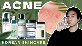 ACNE Treatment  6 Korean Skincare for Oily amp Acne Prone Skin 💦 🇰🇷 [upl. by Nelsen]