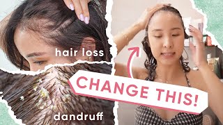 4 Reasons WHY Your Hair Loss amp Dandruff ISN’T Getting BETTER  5 TIPS [upl. by Brittney235]