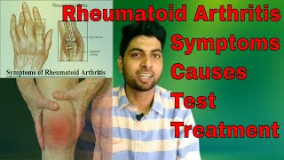 RA Factor Test in Hindi  Rheumatoid Arthritis full Explained in Hindi [upl. by Iniretake]