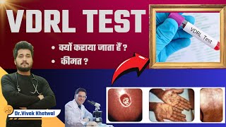 VDRL Test l VDRL Test In Hindi l Dr Vivek Khetwal vdrl youtube [upl. by Scarito726]