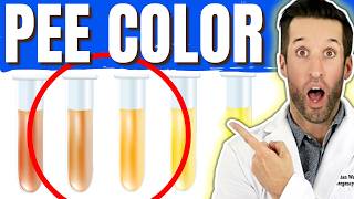 What Your Urine Says About Your Health 10 Signs You Shouldnt Ignore [upl. by Elleuqram]