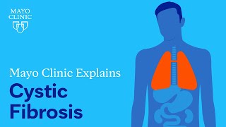 Mayo Clinic Explains Cystic Fibrosis [upl. by Eselrahc]