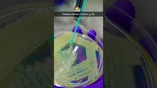 Oxidase test for coliform 🧫🧪🧫microbiologist microbiology bacteria virus fungi microbs [upl. by Mcclenon]