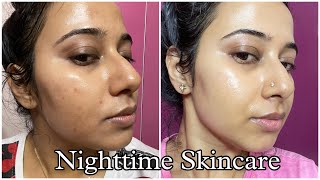 “Unsponsored” 7 Days Tretinoin Skincare Routine for Acne free Glowing skin [upl. by Eihctir]