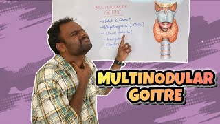 MULTINODULAR GOITRE  THYROID  MEDICINE  SURGERY  SHEELAM SRUJAN [upl. by Feinberg69]