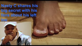 Nasty C shares his big secret with his fans about his left toe [upl. by Anilam381]