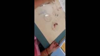 Chick Embryo Dissection Part 2 [upl. by Caassi]