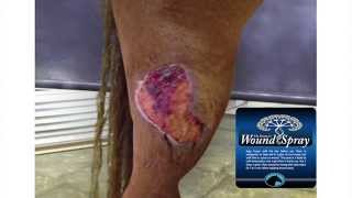 Dr Riddles Wound Spray time lapse wound healing video [upl. by Atiluap977]