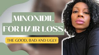 A complete guide to Minoxidil for female hair loss  the good bad and ugly The real tea [upl. by Steck]