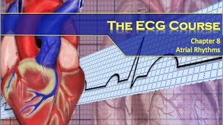 The ECG Course  Atrial Rhythms [upl. by Ttergram]