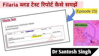 How To Read Filaria Blood Test Report Dr Santosh Singh Episode 25 [upl. by Tijnar]