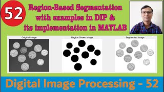 RegionBased Segmentation with examples in DIP and its implementation in MATLABGrowingSplitMerge [upl. by Stanwin]