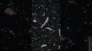 Diatoms [upl. by Meletius700]