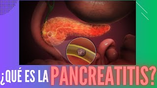 ¿Qué es la pancreatitis [upl. by Boor]