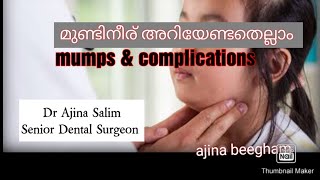 മുണ്ടിനീരു നിസാരക്കാരൻ അല്ല mumps complications and treatment [upl. by Arat]