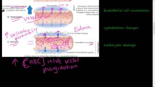 19  Acute Inflammation 1 of 3  Vascular permeability Vasodilation [upl. by Dranik]