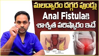 ఫిస్టులకి సరైన చికిత్స  Best Treatment for Anal Fistula  Dr Sridhar Reddy Kareddy  Vikram Tv [upl. by Eerpud]