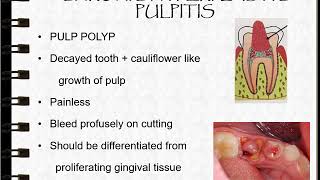 Sequelae of Pulpitis Part 1 [upl. by Auohp449]