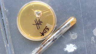 Cladosporium spp   Mycology [upl. by Dickey]