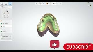 Flexible Partial Denture dentistry smile [upl. by Atinomar]