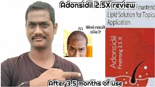 Adonsidil Finstrong 25 X review after using for 105 days Honest review [upl. by Ragas]