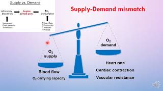 Treatment of angina [upl. by Minni]