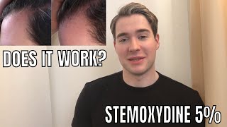 STEMOXYDINE 5 REVIEW  Kerastase Densifique Homme [upl. by Larina639]