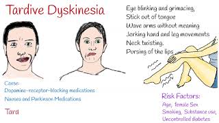 Tardive dyskinesia Causes Symptoms and Treatment [upl. by Sibby]