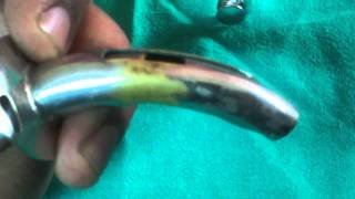 fullers bivalved metallic tracheostomy tube [upl. by Ettesyl]