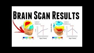 PROOF NEUROHACKING REWIRES THE BRAIN  EEG Brain Scan Reading Breakdown [upl. by Seda623]