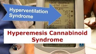 Hyperventilation Syndrome and Hyperemesis Cannabinoid Syndrome [upl. by Garda]