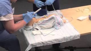 Using a Meconium Aspirator [upl. by Lexie]