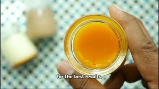 Natural Remedy for Varicose Veins Simple DIY Treatment to Improve Circulation [upl. by Gertrud]