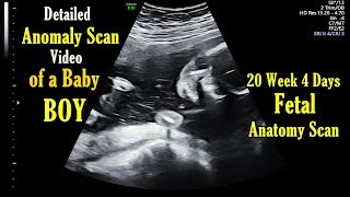 20 Week 4 Days Anomaly Scan in Pregnancy  Detailed Anatomy USG Scan of Baby Boy [upl. by Neerual]