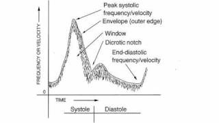 Doppler Ultrasound Physics 3 [upl. by Atiuqihc]