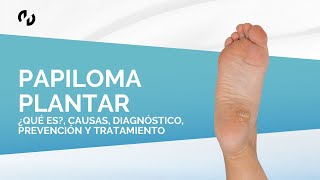 Papiloma plantar ¿Qué es causas diagnóstico prevención y tratamiento [upl. by Lemraj971]