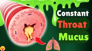 6 Real Causes of Phlegm amp Mucus in Your Throat Stop Constant Throat Clearing  VisitJoy [upl. by Akinna388]